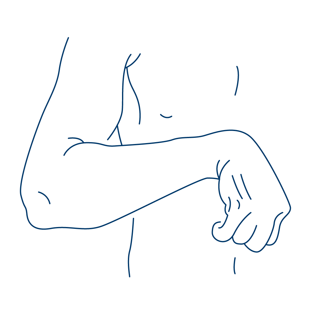 Illustration von einem gebeugten Ellenbogen bei einer Spastik