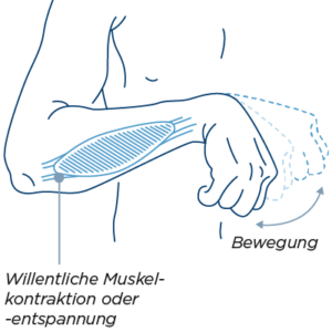 Diagramm zeigt Muskelkontraktion im Arm, relevante Funktion bei Spastik.